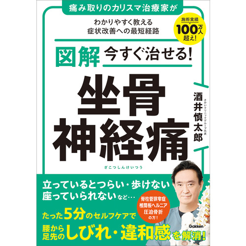 図解　今すぐ治せる！　坐骨神経痛