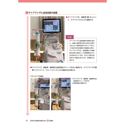 臨床工学技術ヴィジュアルシリーズ|動画と写真でまるわかり！ 血液透析