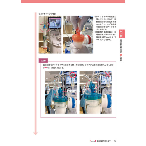 臨床工学技術ヴィジュアルシリーズ|動画と写真でまるわかり！ 血液透析