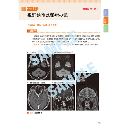 Ｇｅｎｅｒａｌ Ｒａｄｉｏｌｏｇｙ画像診断演習|木口貴雄(著) 井上 