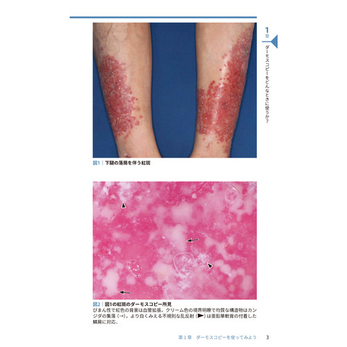 ダーモスコピー超簡単ガイド 改訂第2版|田中 勝(著)|ショップ学研＋